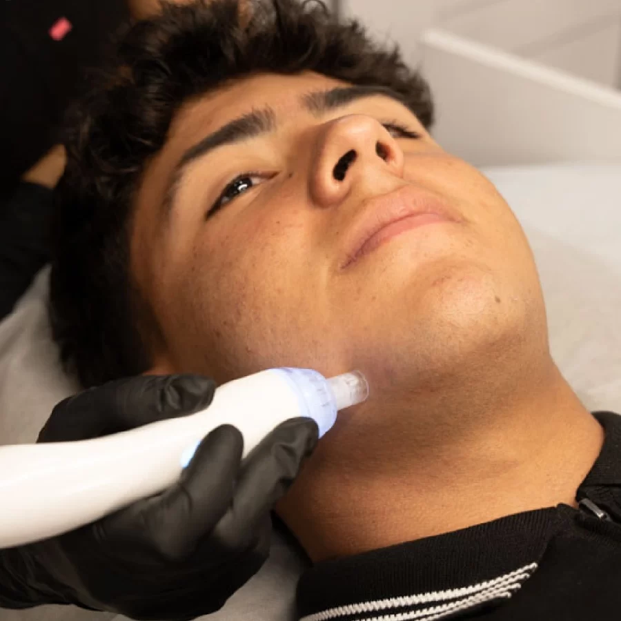 limpieza-facial